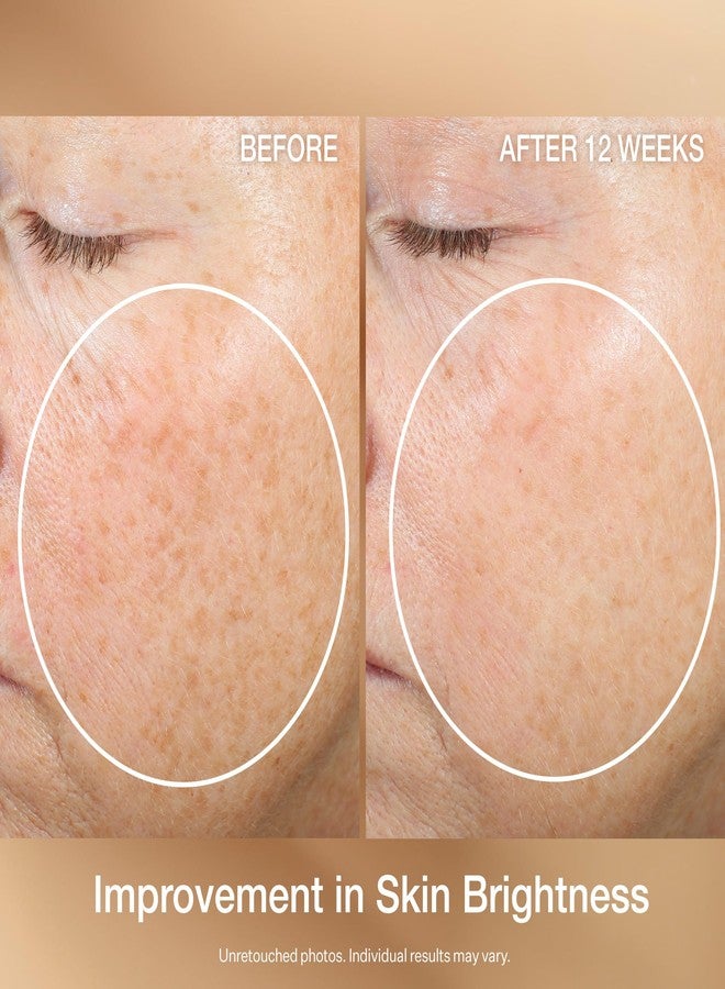StriVectin Multi Action Super C Retinol Brightening & Correcting Serum 1.7oz - Image 5